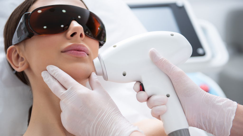 Lazer for Ance - Myrakia Beauty Bar