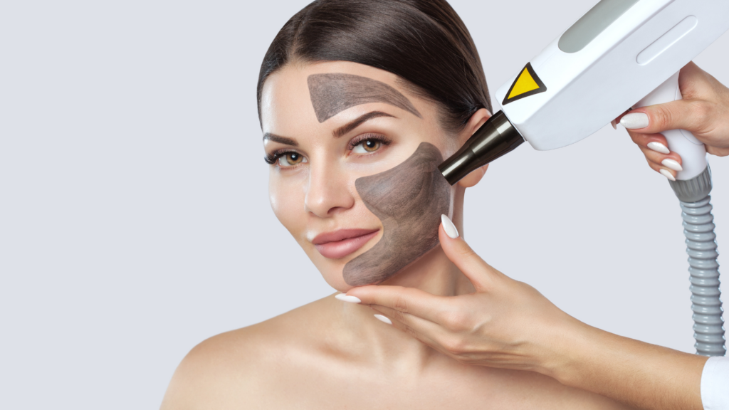 Carbon Laser Facial - Myrakia Beauty Bar